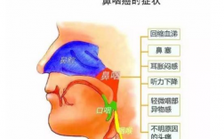 鼻腔和鼻窦癌的发病原因